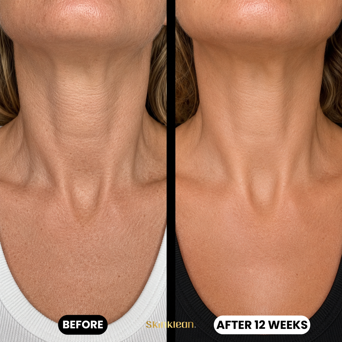 Triple Collagen Plumping Gel Décolleté Mask