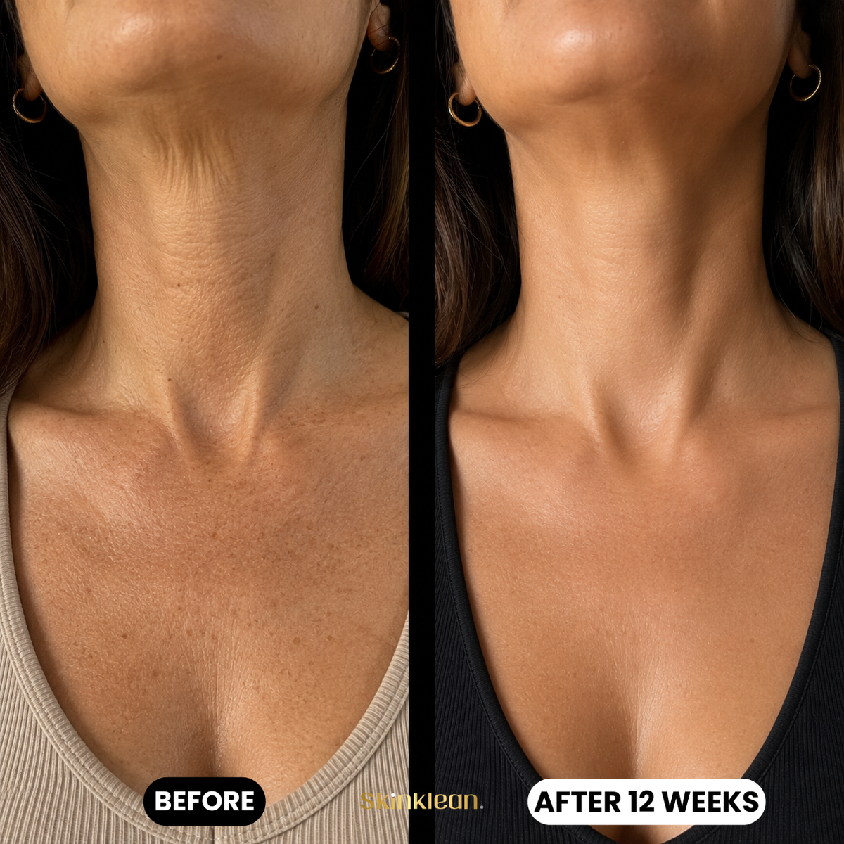 Triple Collagen Plumping Gel Décolleté Mask