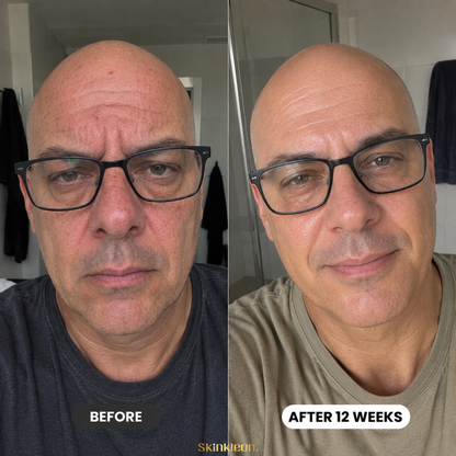Triple Collagen Plumping Gel Mask Men