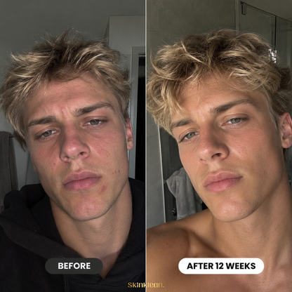Triple Collagen Plumping Gel Mask Men