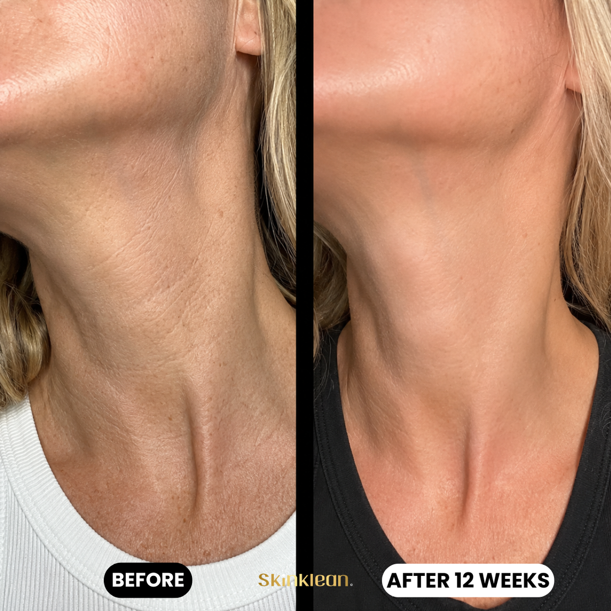 Triple Collagen Plumping Gel Neck Mask