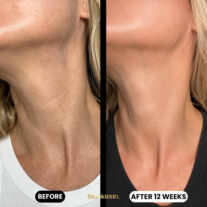 Triple Collagen Plumping Gel Neck Mask