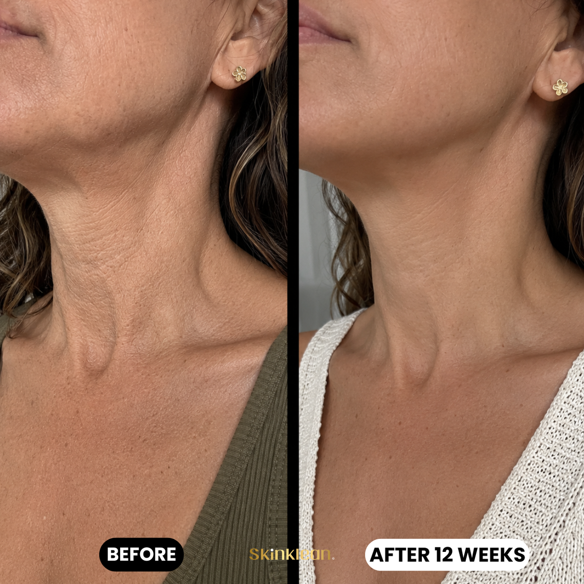 Triple Collagen Plumping Gel Neck Mask